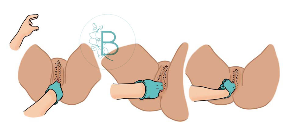 Ilustraciones para clínica de fisioterapia perineal «Berkana».